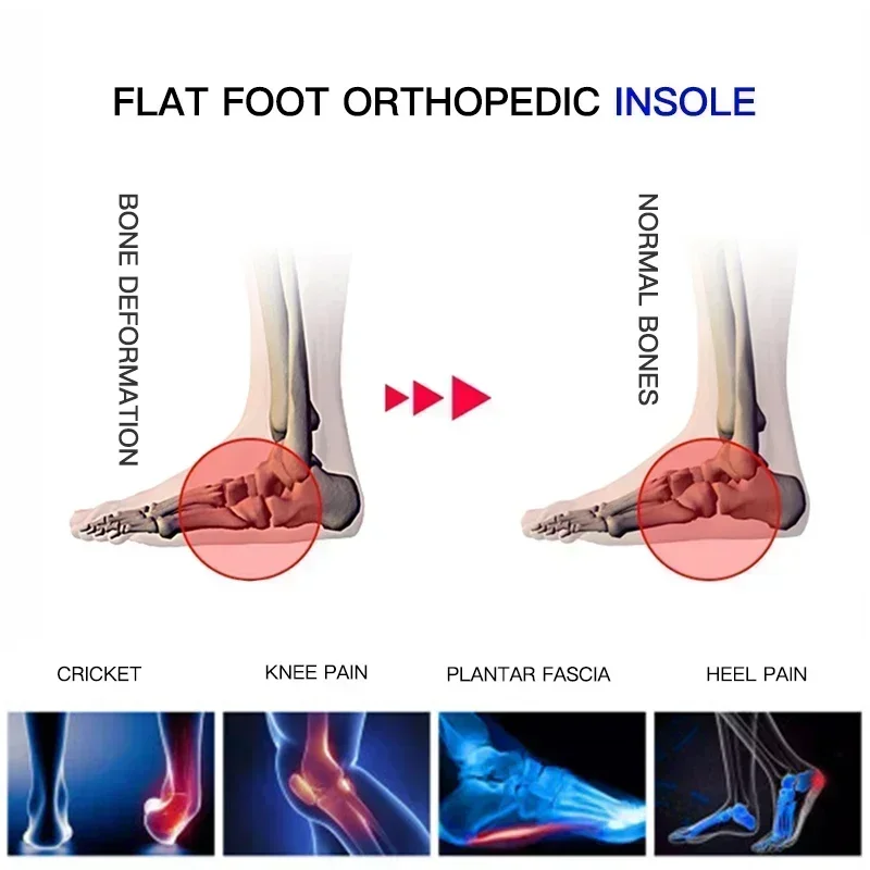 プロ仕様アーチサポートインソール扁平足矯正靴クッション整形外 - Cycling Shoe Insoles のレビューと価格